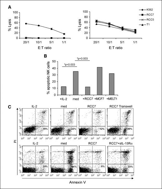 Figure 4. MbIL-15 on RCC cells rescues NK cells from apoptosis induced by IL-2 starvation. A, percentage lysis of tumor targets (K562, RCC5, RCC7, and MELT1 cells) by resting NK (left) and IL-2–activated NK cells (right). MbIL-15 in RCC cells did not interfere with resting NK cell–mediated lysis. B, IL-2–starved NK cells (med) were layered on tumor cells (RCC7, MCF7, and MELT1) for 20 h before Annexin V/propidium iodide (PI) labeling in CD56+-gated NK cells. Results are expressed as mean percentages of apoptotic NK cells. C, addition of a Transwell between RCC7 and NK cells abrogated survival of NK cells. Masking of MbIL-15 with saturating concentrations of sIL-15Rα (1.5 μg/mL) partially restored apoptosis in IL-2–starved NK cells. One of five experiments.
