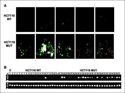 Figure 5. PIK3CA mutations promote tumor metastasis. A, HCT116 WT and MUT cells were labeled with GFP and injected s.c. into athymic nude mice. Tumor xenografts were implanted as described above. Lung metastases were detected at autopsy by GFP imaging. Photographs show representative examples of GFP imaging results. B, one of the lungs from each mouse was harvested on day 35 and RNAs were isolated. Top, RT-PCR assays were done to detect the mRNA level of human-specific GAPDH; bottom, nonspecific GAPDH was used as loading control. RNA from normal mouse lungs was used as negative control.