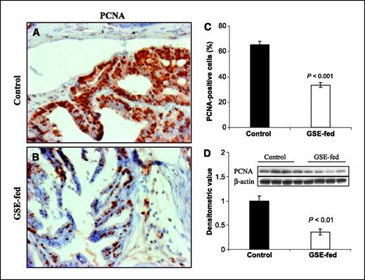 Figure 3. In vivo antiproliferative effect of GSE feeding on dorsolateral prostate in TRAMP mice. A and B, immunohistochemical staining for PCNA (×400 magnification) in prostate was based on 3,3′-diaminobenzidine staining as detailed in Materials and Methods. C, quantification of PCNA-positive cells for determination of proliferation index. Columns, mean of 20 samples in each group; bars, SE. P < 0.001 (Student's t test). D, four prostate tissue samples from individual mice were randomly selected from each group for PCNA immunoblotting. Reactive protein bands were visualized by enhanced chemiluminescence detection system, and membrane was stripped and probed with β-actin as loading control. Densitometric analysis of the PCNA band intensity adjusted with β-actin. Columns, mean of the four bands from individual mouse prostate in each group; bars, SE. P < 0.01 (Student's t test).