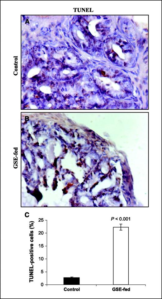 Figure 4. In vivo proapoptotic effect of GSE feeding on dorsolateral prostate in TRAMP mice. A and B, apoptosis was analyzed by TUNEL staining in prostate tissues as detailed in Materials and Methods. Brown-colored TUNEL-positive cells depicted at ×400 magnifications. C, apoptotic index was calculated as the number of positive cells × 100 / total number of cells counted under ×400 magnification in 10 randomly selected areas in each sample (n = 20). Columns, mean; bars, SE. P < 0.001 (Student's t test).