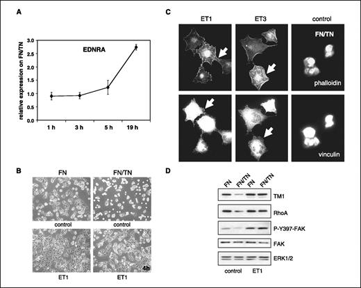 Figure 1. Kinetics of EDNRA expression and restoration of cell adhesion by ET1 on FN/TN-C. A, expression of EDNRA was determined by real-time-RT-PCR in T98G cells on plating on fibronectin and FN/TN-C and after RNA preparation at the indicated time points. Expression of EDNRA on FN/TN-C is expressed as fold difference in comparison with fibronectin alone. GAPDH expression was used for normalization. T98G cells were plated for 4 h on fibronectin and on FN/TN-C in the presence and absence of ET1 before documentation of cell adhesion (B), lysis and immunoblotting for FAK, RhoA, TM1, and ERK1/2 (D), or immunofluorescent staining for polymerized actin (arrow) with TRITC-phalloidin and for focal adhesions (arrow) with an anti-vinculin antibody (C). Control: serum-free medium.