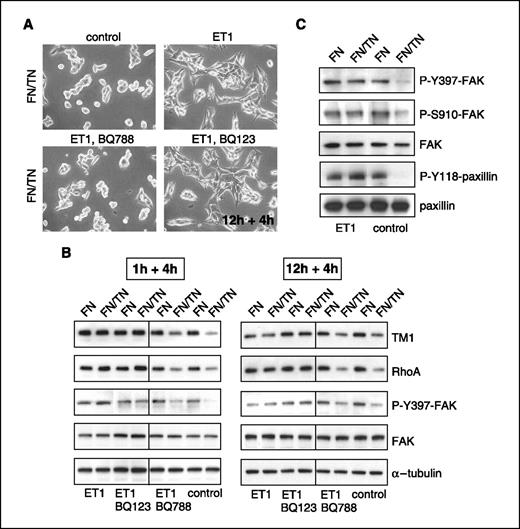 Figure 2. EDNRB activation inhibits cell rounding on FN/TN-C. T98G cells were plated on fibronectin (data not shown) and FN/TN-C in serum-free medium for 1 h (B and C) and 12 h (A and B) before addition of ET1 in the presence and absence of the EDNRA and EDNRB inhibitors BQ123 and BQ788, respectively, for another 4 h. A, documentation of cell adhesion. B and C, immunoblotting for the indicated molecules. Control: serum-free medium plus DMSO.
