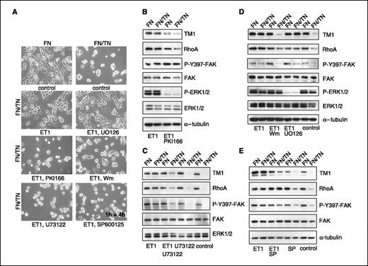 Figure 3. EDNRB activation induces cell spreading dependent on EGFR, PLC, PI3K, and JNK. T98G cells were plated on fibronectin or FN/TN-C for 1 h in serum-free medium before addition of ET1 and DMSO in the presence or absence of the respective inhibitors. A, documentation of cell adhesion. B to E, immunoblotting. Control: see Fig. 2.