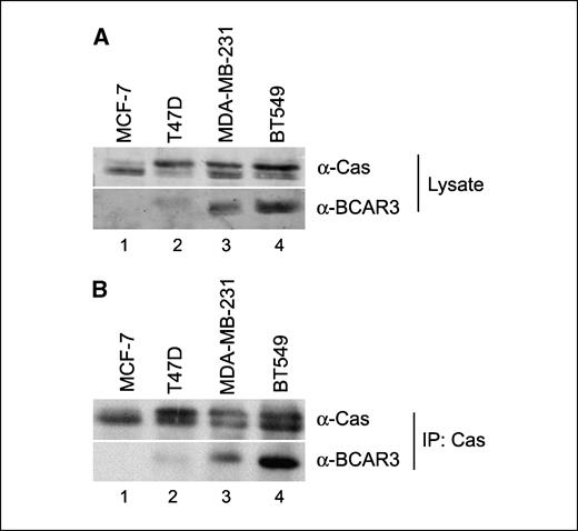 Figure 1. BCAR3 and p130Cas are coexpressed and in complex in multiple breast cancer cell lines. Fifty micrograms of total cell lysate (A) or p130Cas immune complexes isolated from 500 μg cell extract (B) were separated by 8% SDS-PAGE and immunoblotted with antibodies recognizing p130Cas (top) or BCAR3 (bottom). IP, immunoprecipitation.