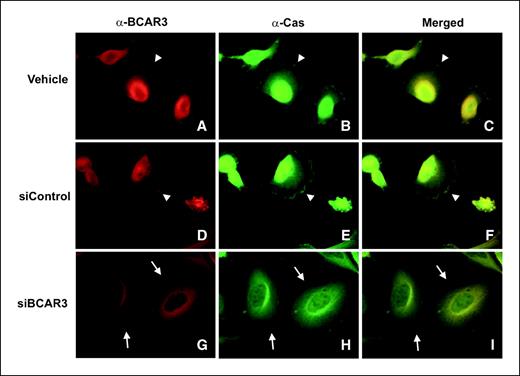 Figure 5. Depletion of BCAR3 from BT549 cells results in a loss of both BCAR3 and p130Cas from membrane ruffles. BT549 cells were treated with vehicle (H2O), control, or BCAR3-targeted siRNAs as described in Fig. 4. Forty-eight hours posttransfection, cells were replated onto fibronectin-coated coverslips in serum-containing medium, allowed to spread for 4 h, and processed for epifluorescence. BCAR3 and p130Cas were visualized as described in Materials and Methods, maintaining equal exposure lengths for each antibody. Merged images (C, F, and I). Arrowheads, sites of BCAR3-p130Cas colocalization at membrane ruffles. Arrows, sites of membrane ruffles devoid of BCAR3 and p130Cas in cells treated with BCAR3-targeted siRNA (G–I).