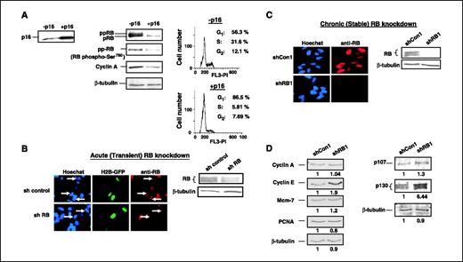 Figure 1. RB knockdown in prostate cancer cells causes deregulation of RB/E2F target genes and compensation by RB family members. A, LNCaP cells were infected with p16INK4a adenovirus. Following culture for 36 to 48 h, cells were harvested, lysed, and immunoblotted as indicated. β-Tubulin is included as the loading control (left and middle). p16INK4a-infected cells were analyzed in parallel for cell cycle position (right). B, cells were transfected with pMSCV-puroRb3C or pMSCV-puro and H2B-GFP as a marker for transfection. Transfected cells were visualized for RB staining by indirect immunofluorescence (40× magnification; left), and corresponding lysates were monitored for RB expression levels by immunoblot (right). C, stable clones of RB knockdown (shRB1) or control (shCon1) were generated and tested for RB expression levels using immunofluorescence (40× magnification; left) and immunoblot analysis (right). D, immunoblot analysis of shRB1 and shCon1 cells to monitor alteration of E2F targets (cyclin A, cyclin E, Mcm-7, PCNA). β-Tubulin is included as a loading control (left). Relative expression in shRB1 (normalized to β-tubulin and compared with shCon1) is indicated as determined by LICOR fluorescence. Lysates from shRB1 and shCon1 cells were subjected to immunoblot analyses to examine p107 and p130. β-Tubulin served as a loading control, and relative expression is indicated (right).
