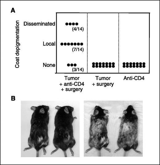 Figure 6. Melanoma growth in the absence of Treg cells induces postsurgical autoimmunity against normal host melanocytes. A, mice (14 per group) received B16 primary tumors on the right flank (day 0) with or without anti-CD4 treatment (days 4 and 10) and surgery (day 12) as indicated on the X axis. No challenge tumor was given. Two days following surgery, mice were depilated on the left flank to induce hair regrowth at a site distal to the excised tumor. The extent of coat depigmentation was recorded 50 d following surgery (or 50 d following anti-CD4 treatment in mice that had not received surgery). Y axis, None, a completely black coat; Local, a patch of white fur on the right flank; Disseminated, a patch of white fur on the right flank in addition to white patches in other locations. B, photographs of two representative mice with local depigmentation were taken 50 d following surgery (left) and again 80 d after surgery, showing progressive dissemination of depigmentation (right). This experiment was conducted thrice with similar results.