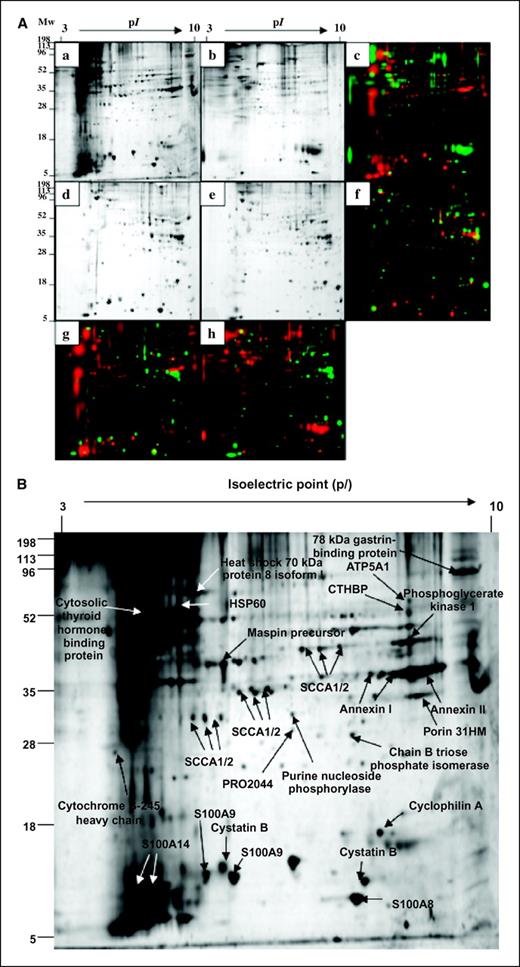 Figure 2. Comparison of protein expression in squamous and mucous differentiated NHTBE cells determined by two-dimensional PAGE analysis. A, representative images from two-dimensional PAGE analysis showing ASF from squamous differentiated NHTBE cells (a; red channel); ASF from mucous differentiated NHTBE cells (b; green channel); merged images of a and b (c); whole-cell lysate from squamous differentiated NHTBE cells (d; green channel); whole-cell lysate from mucous differentiated NHTBE cells (e; red channel); merged image of d and e (f); merged image of a and d (g); and merged image of b and e (h). Representative of three independent experiments. B, representative two-dimensional PAGE images of ASF from squamous differentiated NHTBE cells. Arrows with annotations, protein spots identified by liquid chromatography-tandem mass spectrometry. The identified proteins are listed in Table 1.