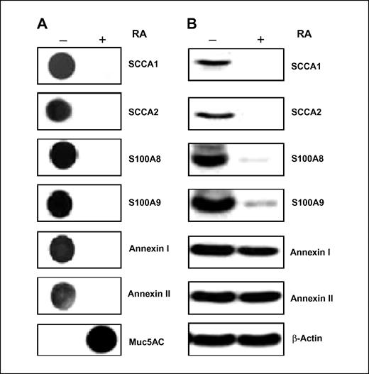 Figure 3. Dot-blot and Western blot analyses of differentially expressed proteins. ASF and whole-cell lysates from squamous differentiated (−RA) and mucous differentiated (+RA) NHTBE cells were analyzed by dot-blot (A) and Western blot (B) analyses as described in Materials and Methods. MUC5AC was used as an indicator of mucous cell differentiation. β-Actin was used as a loading control for Western blot analysis. Representative of three independent experiments.