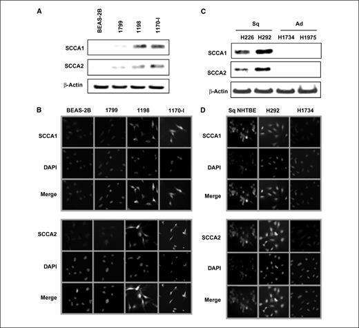 Figure 4. Expression of SCCA1 and SCCA2 in syngeneic in vitro lung carcinogenesis model cell lines and non–small-cell lung cancer cell lines. A, equal amounts of whole-cell lysates isolated from immortalized human bronchial epithelial cells (BEAS-2B and 1799), transformed cells (1198), and malignant cells (1170-I) were subjected to Western blot analysis with anti-SCCA1 and anti-SCCA2 antibodies. B, cells grown on chamber slides were subjected to immunofluorescence analysis with the same antibodies. Nuclei were stained with 4′6′-diamidino-2-phenylindole (DAPI) and the images were merged. C, equal amounts of whole-cell lysates from non–small-cell lung cancer cell lines (squamous cell carcinoma cell lines H226 and H292 and adenocarcinoma cell lines H1734 and H1975) were subjected to Western blot analysis with anti-SCCA1 and anti-SCCA2 antibodies. D, cells grown on chamber slides were subjected to immunofluorescence analysis with the same antibodies. Nuclei were stained with DAPI and the images were merged. Representative of three independent experiments.