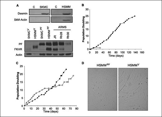 Figure 1. Stable ectopic expression of PAX3-FKHR in low passage primary human Skeletal muscle cells enables bypass of cellular senescence in vitro. A, top, desmin and SkM-actin immunoblots of starting cell SKMC and HSMM cell lysates. HEK-293T lysate included as a negative control (C). Bottom, FOXO1A immunoblot of SKMCs and HSMM cells stably transduced with vector or PAX3-FKHR compared with human ARMS cell lines (JR, Rh28, and Rh3) known to harbor t(2;13). Note that anti-FOXO1A antibody recognizes both endogenous FOXO1A (FKHR) and the higher molecular weight PAX3-FKHR. Actin immunoblot is included as a loading control. Sample in lane two is partially degraded, as FKHR band is shifted in mobility and actin band diminished. B, proliferation curve of SKMCs expressing vector (○) or PAX3-FKHR (•). C, proliferation curve of HSMM cells expressing empty vector (○) or PAX3-FKHR (•). D, phase-contrast microscopy of post-senescent HSMM cells expressing PAX3-FKHR (HSMMPF) or senescent HSMM cells expressing vector (HSMMV).