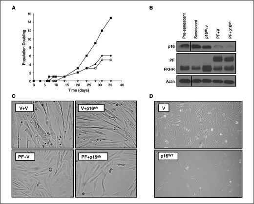 Figure 3. Loss of p16INK4a by shRNA cooperates with expression of PAX3-FKHR to promote myoblast proliferation past senescence. A, HSMM cells were engineered to stably express empty vectors (⋄), p16INK4A shRNA (♦), PAX3-FKHR (□), or both the p16INK4A shRNA and PAX3-FKHR (▪). Polyclonal populations emerging from selection were grown in culture and population doublings monitored to determine ability to bypass senescence. B, p16INK4A and FOXO1A immunoblots of the four cell lines described compared with pre-senescent control. Actin immunoblot is included as loading control PF, PAX3-FKHR; V, vector. C, light microscopy reveals the unique morphology of the four cell lines described in (A). D, phase-contrast microscopy of post-senescent HSMM cells stably infected with amphotrophic retrovirus encoding empty vector (top) or WT p16INK4A cDNA (bottom).