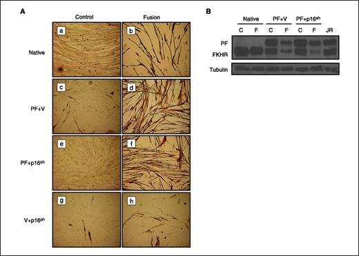Figure 4. PAX3-FKHR does not promote bypass of cellular senescence by suppressing the differentiation pathway. A, immunohistochemical staining of the indicated cell lines using the anti–sarcomere-myosin hybridoma MF20 to detect terminally differentiated myotubes. Control (a, c, e, and g), cells were cultured in the usual growth media; fusion (b, d, f, and h), cells were cultured in media to stimulate differentiation of single-cell myoblasts to fused, multinucleate elongated myotubes. Dark brown-black staining indicates MF20 staining. Magnification, ×10. B, FOXO1A immunoblot of cellular lysates derived from native, PF+V, and PF+p16sh cells described in (A). V+p16sh cells could not be analyzed in this experiment because they grew poorly in fusion media, and lysates were too dilute. Tubulin immunoblot is included as a loading control. C, control media; F, fusion media; JR, control human JR ARMS cell lysate.