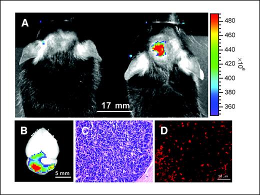 Figure 2. Detection of autochthonous medulloblastoma in genetically engineered mice. A, biophotonic images of tumor-free wild-type mouse (left) and ND2:SmoA1 mouse (right). Mice were injected with 0.2 mL of 10 μmol/L probe 1.5 d before imaging. Representative sample shown from five mice with similar results. B, images of brains from the same mice following necropsy confirms signal from tumor. C, histologic confirmation of medulloblastoma tumor. D, confocal microscopy images from the same brains shown in (B) demonstrating the near absence of Cy5.5 signal in control and presence in medulloblastoma.