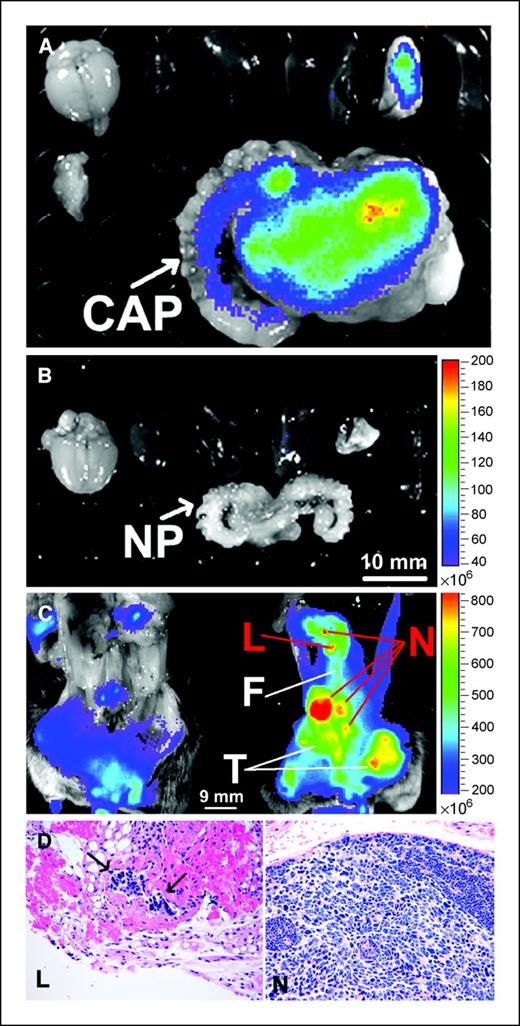 Figure 3. Specificity of CTX:Cy5.5 for human and mouse prostate cancer. A, biophotonic image of prostate and other organs from TRAMP mouse. CAP, cancerous prostate. B, wild-type control shows specific signal in TRAMP prostate and lung. Representative image from three animals in each group. Images were obtained 5 d after injection of 0.1 mL of 10 μmol/L probe. Top row, brain, heart, kidney, liver, lung, and spleen. Bottom row, NP, normal prostate. C, intraoperative images of control (left) and TRAMP (right) mouse abdomen following removal of intestine, prostate, and liver. Multiple lymph nodes (N) were positive by biophotonic imaging and histology. A 1.5-mm-diameter tissue nodule that was very bright on imaging revealed a small focus of prostate cancer cells in lymph channels surrounded by fat and reactive tissue (L). Lower amounts of signal were detected in fat (F) and testes (T). D, H&E stain showing cancer focus in lymph channel and cancer packed lymph node (data not shown).