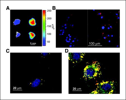 Figure 6. MMP-2 and CTX:Cy5.5 trafficking. A, inhibition of CTX:Cy5.5 binding by the MMP-2 blocker in 9L glioma xenograft tumor, 1,10-phenanthroline (left, top and bottom) compared with binding in control mice that did not receive 1,10-phenanthroline (right). B, mock-transfected MCF7 cells (left) and MCF7 cells transfected with a plasmid encoding MMP-2 (right) by NIRF microscopy after 2 h incubation with 1 μmol/L CTX:Cy5.5 (red) and DAPI nuclear stain (blue). Shown are representative images from three independent experiments. C and D, confocal images of (C) mock-transfected and (D) MMP-2–transfected MCF7 cells showing staining with MMP-2 antibody (green), CTX:Cy5.5 (red), and colocalization of both (yellow) and DAPI (blue).