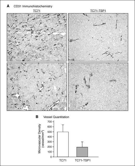 Figure 6. A, immunohistochemical staining of TC71 tumor explants. Anti-CD31 antibody staining indicates the microvessel density of the tumors from mice injected with TC71-TSP1 or TC71 vector control cells. B, quantitation of microvessels from five independent tumors of each cell condition. Three regions of each section with the strongest staining were captured using a charge-coupled device camera. The images were analyzed with ImagePro software to quantitate the positive stained events within each field, averaged, and represented in the histogram. The observed difference between TC71-TSP1 and TC71 control tumors are statistically significant (P < 0.05).