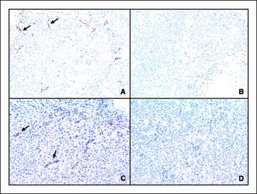Figure 3. Immunohistochemistry of L2987 xenografts with collagen type IV (A and B) and with C1QR1 (C and D). A and C, pretreatment samples; B and D, posttreatment samples. Brown, presence of the protein (arrows); blue, hematoxylin counterstain. Images were taken with a 10× objective.