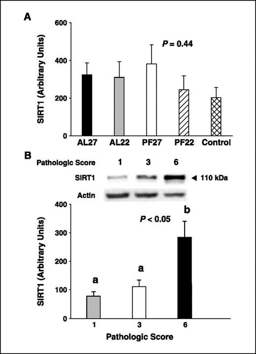 Figure 2. SIRT1 protein content in the DLP from TRAMP mice. A, SIRT1 protein expression in the DLP of TRAMP mice in the 6-week feeding experiment. Mean protein expression for SIRT1 in the DLP from experimental groups. There were no significant differences among groups (P = 0.44). B, SIRT1 protein expression in the DLP of TRAMP mice in the SIRT1 and cancer stage experiment with pathologic score of 1 (n = 5), 3 (n = 6), or 6 (n = 6), indicating normal tissue, high-grade PIN, or poorly differentiated prostatic adenocarcinoma, respectively. Representative Western blot (top). Mean protein expression for SIRT1 in the DLP at each pathologic score (bottom). Columns, mean; bars, SE. Different letters denote (a and b) a significant difference between groups, such that groups not sharing a similar letter are significantly different from each other (P < 0.05).