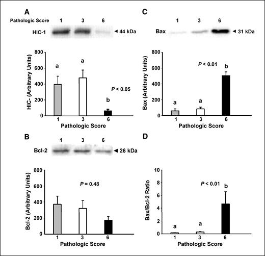 Figure 4. DLP protein content from TRAMP mice with pathologic score of 1 (n = 5), 3 (n = 6), or 6 (n = 6), indicating normal tissue, high-grade PIN, or poorly differentiated prostatic adenocarcinoma, respectively. A representative Western blot and corresponding figure are shown. Mean protein expression in the DLP from TRAMP mice with different pathologic scores for HIC-1 (A), Bax (B), Bcl-2 (C), and the Bax/Bcl-2 ratio (D). Columns, mean; bars, SE. Different letters (a and b) denote a significant difference between groups, such that groups not sharing a similar letter are significantly different from each other (P < 0.05).
