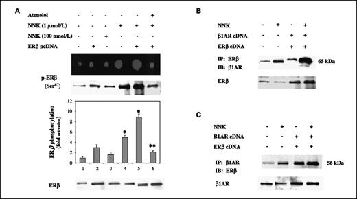 Figure 2. NNK stimulates ERβ phosphorylation in a dose-dependent manner and induces ERβ-β1AR complex formation. A, ERβ transfected and untransfected HPL1D were exposed to 100 nmol/L to 1 μmol/L NNK for 1 h with or without pre-exposure to 100 nm E2 (10 min) or 1 μmol/L atenolol (10 min). Phosphorylation of ERβ in these samples was analyzed by reverse-phase proteomics, and spot images were generated with GenePix 4000B microarray scanner. In a parallel, ERβ proteins were immunoprecipitated with ERβ antibody, immunoblotted with p-ERβ (Ser87), and analyzed with autoradiography. In addition, 250 μg of precleared protein lysates from ERβ and β1AR cotransfectants were either immunoprecipitated (IP) with anti-ERβ and immunoblotted (IB) with β1AR antibodies (B), or immunoprecipitated with β1AR and immunoblotted with ERβ antibodies (C). Columns, mean of three different experiments; bars, SD. *, P < 0.05, compared with untransfected and untreated cells (control). **, P < 0.05, compared with ERβ transfectants treated with 1 μmol/L NNK. Expression levels of ERβ and β1AR were monitored by Western blot.