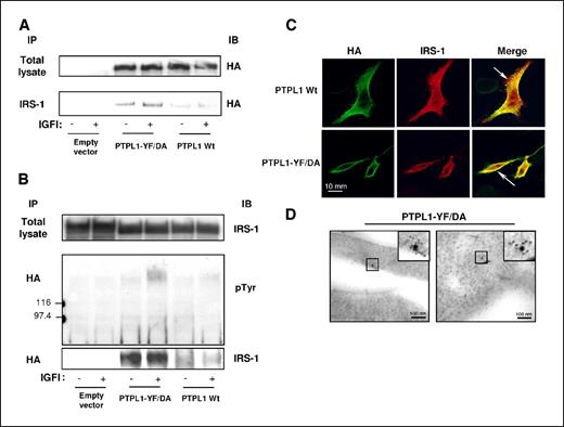 Figure 4. PTPL1-DA complexes with IRS-1 in cellulo. IRS-1 and IGFI-R were transiently cotransfected with either the HA-tagged full-length PTPL1 Wt or PTPL1-DA expression vectors into HEK293 or HeLa cells. A, IRS-1 was immunoprecipitated from lysates prepared from IGFI treated (+) or untreated (−) HEK293 cells and immunoblotted for the presence of PTPL1 using anti-HA antibodies (bottom). An equal expression level of PTPL1 and mutant was confirmed by direct immunoblotting of lysate (top). B, PTPL1 was immunoprecipitated from the same lysates using anti-HA antibodies and immunoblotted for the presence of associated tyrosine-phosphorylated proteins (middle). Reprobing of the blot with anti-IRS-1 allows confirmation that the unique phosphoprotein is IRS-1 (bottom). An equal expression level of IRS-1 was confirmed by direct immunoblotting of lysate (top). C, HeLa cells were treated for indirect FITC localization of PTPL1 constructs with anti-HA antibody (left) and indirect TRITC localization or IRS-1 (middle). Images represent merges of horizontal confocal sections (right). D, HEK293 cells were subjected to double immunogold labeling in scanning electron microscopy. HA PTPL1-DA was visualized by 6-nm gold particles and IRS-1 by 15-nm gold particles. Left, enlargement of microvilli-like protrusions; right, apical submembrane region. Bar, 100 nm.