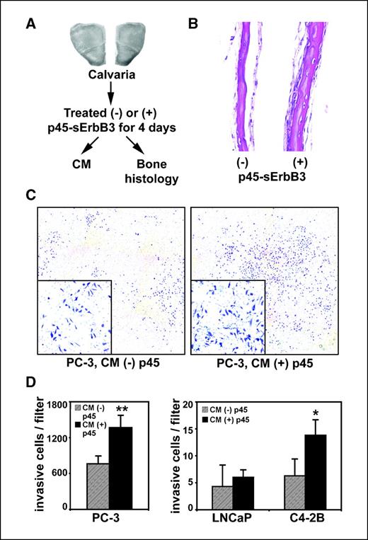Figure 1. Factors secreted by osteoblasts exposed to p45-sErbB3 enhance the invasiveness of prostate cancer cells. A, experimental plan for examining the effect of p45-sErbB3 on mouse calvaria, both in organ culture assays and in conditioned medium (CM). B, histologic analysis indicates that treatment of calvaria with p45-sErbB3 increased calvarial bone formation. C, in Transwell Boyden chambers, conditioned medium from p45-sErbB3–treated calvaria increased the invasiveness of PC-3 cells. Representative microscopic photographs show reassembled images of the entire Transwell membrane, on which cells that migrated to the outside of the upper chamber were stained and counted. D, quantification of the invasiveness of PC-3, LNCaP, and C4-2B cells in response to conditioned medium from p45-sErbB3–treated calvaria in a Transwell assay. *, P < 0.05; **, P < 0.01.
