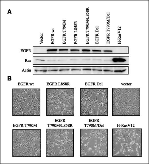 Figure 1. Morphologic transformation of NIH3T3 cells expressing double-mutant EGFR. A, immunoblot of NIH3T3 cells infected with retroviruses encoding the indicated EGFR constructs demonstrating comparable expression of all EGFR constructs (H-RasV12 and actin controls). B, cells expressing EGFR T790M/L858R and EGFR T790M/Del double mutants have striking morphologic differences from parental cells and those expressing EGFR wild-type (wt) or single mutants, as determined by phase-contrast microscopy. Cells expressing H-RasV12 also differ morphologically.