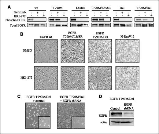 Figure 2. EGFR T790M/Del activity is required for morphologic transformation. A, cells stably expressing various EGFR constructs (shown above) were treated with 10 μmol/L gefitinib, 10 μmol/L HKI-272, or DMSO for 2 h, and were then stimulated with 100 ng/mL EGF for 5 min. Top row, phosphorylated (Phospho) Y992 EGFR; bottom row, total EGFR. B, cells expressing the constructs were grown in 5% serum and treated with 1 μmol/L HKI-272 or DMSO for 6 d to show drug-induced reversion of transformed morphology. C, cells expressing EGFR T790M/Del were infected with lentivirus encoding shRNA against EGFR or a control. D, lysates of infected cells were analyzed by immunoblot to confirm knockdown of EGFR expression. Actin was used as a loading control.