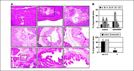Figure 1. A, representative pancreatic histologies of LSL-KRASG12D;PDX-1-Cre mice at 10 months of age. Top left, normal duct; top center, mPanIN-1B; top right, mPanIN-1B high magnification; middle left, mPanIN-2; middle center, mPanIN-2; middle right, mPanIN-2 high magnification; bottom left, mPanIN-3; bottom center, mPanIN-3 high magnification; bottom right, mPanIN-3. Black box, area that was magnified in the following image. B, quantitative analysis of mPanINs in experimental groups. Top, percentage of pancreatic ducts with no pathology (nl), mPanIN-1A (1A), mPanIN-1B (1B), mPanIN-2 (2), and mPanIN-3 (3) lesions in control mice (n = 5) and nimesulide-fed mice (n = 6); bottom, percentage of combined normal ducts/mPanIN-1/mPanIN-2 and mPanIN-3 in control mice and nimesulide-fed animals. *, P < 0.05, control versus nimesulide.