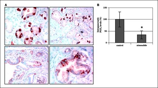 Figure 2. A, COX-2 immunohistochemistry in mPanINs of LSL-KRASG12D;PDX-1-Cre mice at 10 months of age. B, intrapancreatic PGE2 levels in nimesulide-fed animals as measured by ELISA relative to control animals. *, P < 0.05, control versus nimesulide.