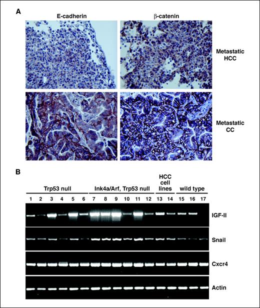 Figure 2. A, reduced expression of E-cadherin and β-catenin in an HCC-derived lung metastasis (middle) and retention of E-cadherin and β-catenin expression in a cholangiocarcinoma-derived lung metastasis (bottom) relative to a primary HCC (top). B, RT-PCR analysis of wild-type, Trp53 null, and Trp53 plus Ink4a/Arf null primary liver tumors. Lanes 1 to 5, Trp53 null tumors. Lane 6, Trp53 null GFP-infected nontumorous liver. Lanes 7 to 11, Trp53 plus Ink4a/Arf null tumors. Lane 12, Trp53 plus Ink4a/Arf null GFP-infected nontumorous liver. Lanes 15 to 17, wild-type tumors. Lane 13, Trp53 plus Ink4a/Arf null HCC cell line MM189. Lane 14, Trp53 null cell line BL185.