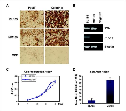 Figure 4. A, immunostaining demonstrating the expression of PyMT and the epithelial marker keratin 8 in cell lines derived from PyMT-induced liver tumors. Mouse embryo fibroblasts (MEF) are used as a negative control. B, RT-PCR analysis for TVA and p16/19 in the HCC cell lines. β-actin serves as a control. Measurement of the proliferation (done in quadruplicate; C) and soft agar colony formation potential (done in triplicate; D) of these cell lines. Data are from representative experiments. Bars, SD.
