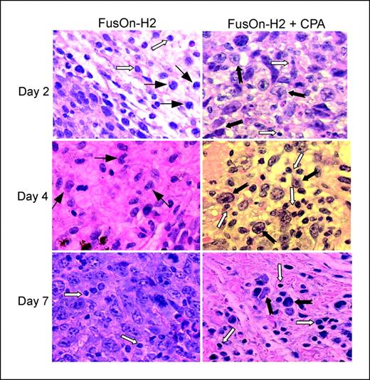 Figure 4. Tumor histology after single- or combined-agent therapy. Tumor nodules were explanted on days 2, 4, and 7 after the start of therapeutic injections. One typical field within H&E-stained tumor sections from mice treated with FusOn-H2 alone or in combination with cyclophosphamide is presented at each time point. The infiltrating lymphoid cells (), monocytic cells (), and LLC cells () are labeled. Some of the indicated tumor cells show degeneration and/or necrosis with prominent vacuolar cytoplasm. Original magnification, ×400.