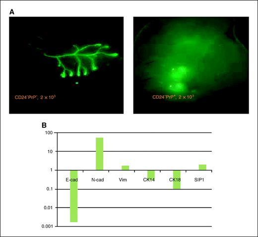 Figure 4. Mammary gland repopulation by 2,000 mammosphere cells initiated from precultured CD24−PrP− cells. A, mammospheres formed by GFP+ CD24−PrP− cells (left) or cell aggregates formed by GFP+CD24−PrP+ cells (right) were dissociated by trypsinization and 2,000 cells were transplanted. Results of whole-mount analysis at 6 wks after transplant. B, real-time PCR analysis of the expression of the E-cadherin (E-cad), N-cadherin (N-cad), vimentin (Vim), cytokeratin 14 (CK14), cytokeratin 18 (CK18), and SIP1 markers in both the freshly isolated nonstem cell CD24+CD49f− population (normalized to 1) and the cultured sphere-forming CD24−PrP−endoglin+ cells. Data of averages from three samples.