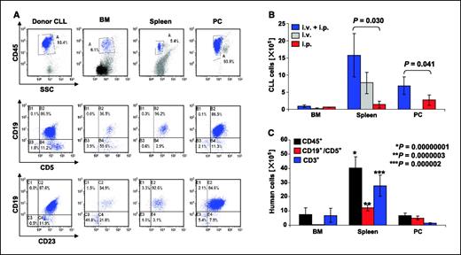 Figure 1. Human B-CLL cells recovered from bone marrow, spleen, and peritoneal cavity of NOD/SCID mice. A, representative flow cytometry plots of cells transplanted (Donor CLL) and cells recovered from bone marrow (BM), spleen, and peritoneal cavity (PC) of animals 4 wks after transplantation exhibit the CLL-typical CD19+CD5+CD23+CD45+ surface phenotype. B, quantitative recovery of human B-CLL cells 4 wks after transplantation of 1 × 108 PBMC i.p., i.v., or via both routes (i.p. + i.p.) in bone marrow, spleen, and peritoneal cavity of NOD/SCID mice. C, quantitative recovery of human CD45+ (▪), B-CLL, or CD3+ human T cells 4 wks after transplantation of 1 × 108 PBMC i.p. and i.v., respectively, in bone marrow, spleen, and peritoneal cavity of NOD/SCID mice. Evaluation of the model with a total of 39 different CLL samples using the i.p. + i.v. combination. Significantly higher engraftment for all three subpopulations could be shown for the spleen when compared with bone marrow or peritoneal cavity. Columns, mean; bars, SEM. SSC, side scatter.