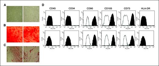 Figure 1. Characterization of human BM-derived MSCs during long-term in vitro culture. A, morphologic appearance of BM-derived MSCs from donor 7 at P3 (left) and P15 (right). MSCs at P15 are smaller in size compared with the same cells at P3, although they maintained the typical spindle shape. Magnification, ×10. B, osteogenic differentiation capacity of MSCs from donor 5 at P3 (left) and P15 (right). The differentiation into osteoblasts is shown by the histologic detection of alkaline phosphatase activity (purple reaction) and calcium deposition stained with Alzarin red. Magnification, ×20. C, adipogenic differentiation capacity of MSCs from donor 5 at P3 (left) and P15 (right). The differentiation into adipocytes is revealed by the formation of lipid droplets stained with Oil Red O. Magnification, ×20. D, immunophenotypic characterization of MSCs from donor 3 at P3 (top row) and P15 (bottom row).