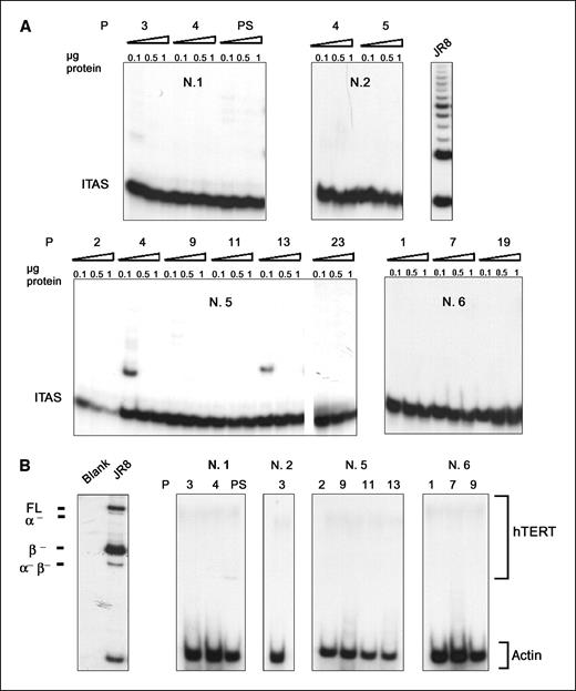 Figure 3. A, telomerase activity of MSC cultures derived from donors 1, 2, 5, and 6 at different passages (P). Telomerase activity was detected by the TRAP assay using different protein concentrations. PS, postsenescence culture. The telomerase-positive cell line JR8 was used as a positive control. The location of the internal amplification standard (ITAS) is reported. B, expression of hTERT mRNA transcripts, including the full-length (FL) and alternative splicing variants α−, β−, and α−β−, as detected by RT-PCR in MSC cultures derived from donors 1, 2, 5, and 6 at different passages. Telomerase subunits were coamplified with β-actin as the internal standard. The telomerase-positive cell line JR8 was used as a positive control. The blank represents a negative control to which no RNA was added.