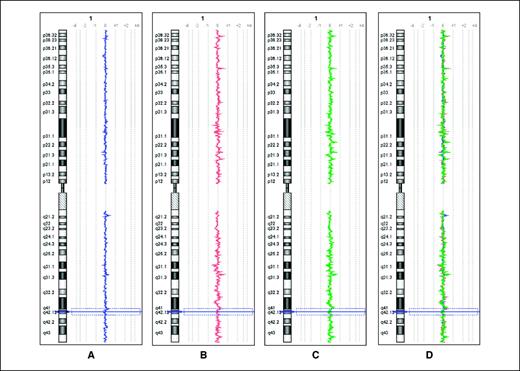 Figure 5. Representative MSC array-CGH profiles of chromosome 1 from donor 6 at (A) T0: PBLs; (B) T1: MSCs at P3; (C) T2: MSCs at P14. D, three overlapping experiments: blue line, PBLs; red line, P3; green line, P14. The array-CGH profiles of MSCs are linear and perfectly overlapped, even when there are duplications or deletions caused by LCVs. This shows that in vitro expanded MSCs do not show unbalanced chromosomal rearrangements.