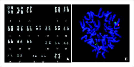 Figure 6. A, normal Q-banding karyotype (360–400 band) of MSCs from donor 2 at P2. B, FISH analysis with chromosome 16 subtelomeric-specific probes on a metaphase from donor 5 at P18. Green signals, subtelomeric regions of the short arm of chromosome 16; red signals, subtelomeric regions of the long arm. The location of signals on chromosome 16 only shows that no translocation involving this chromosome is present.