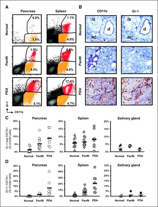 Figure 5. Characterization of myeloid cells in pancreas and spleen of normal, PanIN, and PDA mice. A, representative flow cytometric results for one mouse from each group. Cells were gated for CD45 expression and then analyzed for CD11b versus Gr-1 expression. Numbers, percentages of Gr-1+ CD11b+ MDSC or Gr-1− CD11b+ macrophages among total cells. B, immunohistochemical detection of CD11b and Gr-1 expression in serial sections of normal pancreas (top), PanIN pancreas (middle), and PDA pancreas (bottom). Original magnification, 200×. C, mean percentages of Gr-1− CD11b+ macrophages among total cells in the pancreas (left) were statistically significantly different among normal (triangles; n = 13), PanIN (diamonds; n = 12), and PDA (circles; n = 8) mice as determined by flow cytometry (P < 0.001). Post-hoc testing by the Scheffe test revealed that the increase in macrophages was significant between normal and PanIN pancreata (P = 0.03) rather than between PanIN and PDA pancreata (P = 0.12). Mean percentages of Gr-1− CD11b+ macrophages among total cells in the spleen (middle) were not statistically different among normal (triangles; n = 13), PanIN (diamonds; n = 12), and PDA (circles; n = 8) mice (P = 0.43). There was also no statistically significant increase in the mean percentage of Gr-1− CD11b+ macrophages among total cells in the salivary gland (right). Symbols, data from each animal; bars, mean percentage for the group. D, mean percentages of Gr-1+ CD11b+ MDSC among total cells in the pancreas (left) and spleen (middle) were statistically significantly different among normal (triangles; n = 13), PanIN (diamonds; n = 12), and PDA (circles; n = 8) mice as determined by flow cytometry (P < 0.001 for pancreas and P < 0.001 for spleen). Post-hoc testing by the Scheffe test revealed that the increase in MDSC was significant between PanIN and PDA pancreata (P = 0.004) rather than between normal and PanIN pancreata (P = 0.65). Post-hoc testing by the Scheffe test revealed that the increase in MDSC in the spleen was significant between PanIN and PDA (P = 0.001) rather than between normal and PanIN (P = 0.30). Mean percentages of Gr-1+ CD11b+ MDSC among total cells in the salivary gland (right) were not statistically different among normal (triangles; n = 9), PanIN (diamonds; n = 4), and PDA (circles; n = 5) mice as determined by flow cytometry (P = 0.23). Symbols, data from each animal; bars, mean percentage for the group. Details of the statistical analysis, including mean and SE, are noted in Supplementary Tables S1 and S2.