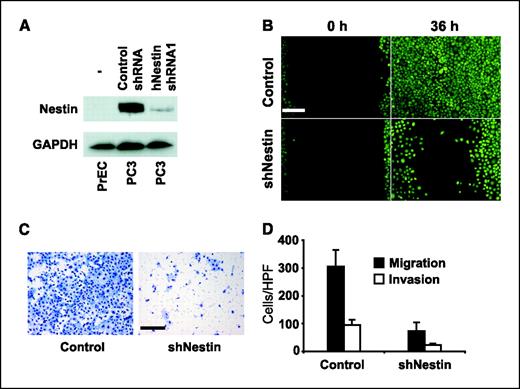 Figure 3. Nestin enhances prostate cancer cell motility. A, Western blot showing diminished Nestin protein levels in human PC3 prostate cancer cells stably transfected with a shRNAmir construct targeting human Nestin (hNestin shRNA1) when compared with the same cells stably transfected with a scrambled control shRNA construct (Control shRNA). Untransfected (−) benign human PrECs lack detectable Nestin protein. GAPDH, glyceraldehyde-3-phosphate dehydrogenase. B, wound healing assay of calcein-stained (green) PC3-control and PC3-siNestin cells. Thirty-six hours after wounding, control cells completely cover the denuded area of the plate, whereas “healing” is markedly inhibited in PC3-siNestin cells. Representative photomicrographs are shown from one of three comparable experiments. Bar, 100 μm. C, photomicrographs of a modified Boyden chamber assay showing that numerous PC3-control cells (left) but only few PC3-siNestin cells (right) traverse an uncoated porous membrane after 20 h. Bar, 100 μm. D, number of cells migrating through uncoated membranes or invading through Matrigel-coated membranes in modified Boyden chamber assays (P < 0.0001). All Boyden chamber assays were done in triplicate. HPF, high-power field. Columns, mean; bars, SD.