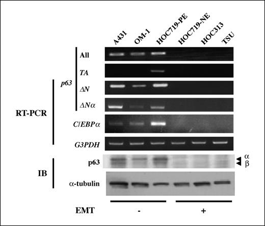 Figure 3. Loss of ΔNp63α and C/EBPα in SCC cells with the spontaneous EMT phenotype. Semiquantitative RT-PCR for p63 and C/EBPα was done in SCC cell lines with (EMT +) or without (EMT −) EMT features. p63 protein levels in these cells were examined by immunoblotting with anti-p63 antibody.