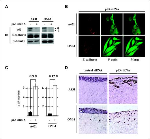 Figure 4. E-cadherin expression, cellular morphology, and invasiveness in p63 knockdown in SCC cells without EMT features. The pooled cells that expressed constitutive p63 silencing shRNA (p63 siRNA +) or control shRNA (p63 siRNA −) were obtained in A431 and OM-1. A, p63 and E-cadherin protein levels in these cells were examined by immunoblotting. B, p63 knockdown cells exhibited intact localization of E-cadherin and F-actin. Red, Alexa Fluor 568–labeled anti-rabbit IgG was used to detect E-cadherin antibody; green, F-actin fibers were stained with Alexa Fluor 488 phalloidin. C, p63 knockdown cells exhibited invasiveness in Matrigel invasion assay. The passed cells through an 8-μm pore size PET membrane with Matrigel were counted as invading cells. X axis, cell numbers per microscopic field after staining with trypan blue. The data represent the mean of six independent fields at ×100 magnification. D, p63 knockdown cells exhibited invasiveness in in vitro three-dimensional culture. The paraffin sections from in vitro three-dimensional culture (see Materials and Methods) were stained with H&E.