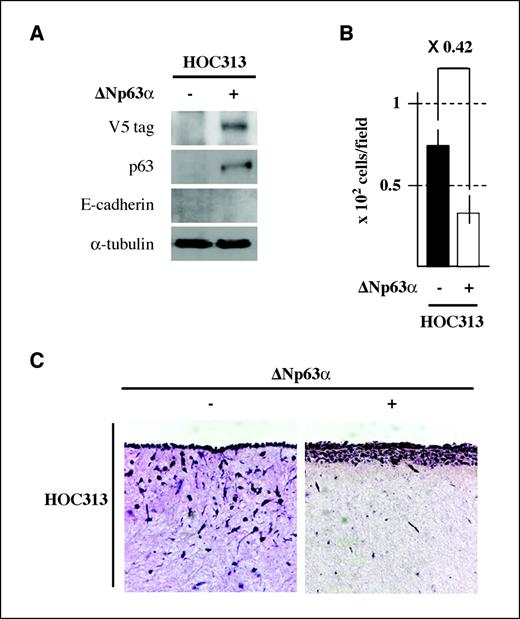 Figure 5. Suppression of the invasiveness of SCC cells with the spontaneous EMT phenotype by reexpression of ΔNp63α. A, expression levels of the ΔNp63α-V5/His tag fusion protein or the E-cadherin in indicated cells. Representable data of Matrigel invasion assay (B) and in vitro three-dimensional cultures (C) using indicated cells.
