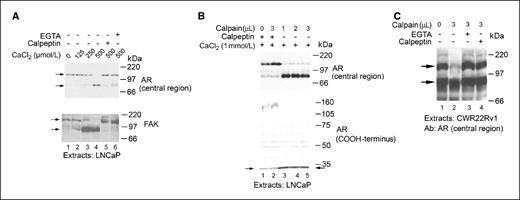 Figure 1. The AR is a calpain substrate. A, Western immunoblot analysis (Ab: AR441) revealed that addition of CaCl2 to LNCaP extracts resulted in cleavage of the AR to a truncated isoform. Addition of calpeptin or EGTA inhibited AR proteolysis. Addition of CaCl2 activates proteolysis of FAK to a 90-kDa isoform. B, addition of purified calpain 2 (0.17 units/μL) to LNCaP extracts promoted AR proteolysis, which was inhibited by calpeptin. An antibody directed against the COOH-terminal region of the AR (C-19) detected the full-length and 30-kDa COOH-terminal fragments. C, treatment of CWR22Rv1 extracts with calpain 2 resulted in the proteolysis of the FL-AR to the truncated isoform.