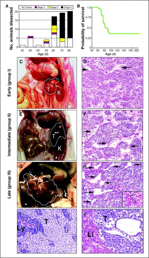 Figure 1. Malignant progression of neuroblastoma in hemizygous mice transgenic for TH-MYCN. A, bar graph of animals dissected at specific time points illustrating the incidence of localized, intermediate, and advanced tumors. B, Kaplan Meier analysis shows that 65% of mice transgenic for TH-MYCN died of tumor by 95 d. C, E, G, gross appearance and grouping of murine tumors at representative ages. D, F, H, H&E staining illustrates similar histopathology for tumors at all groups. Vessel caliber was increased in intermediate and advanced tumors compared with localized tumors (arrows). Regionally spread tumors showed increased necrosis compared with localized tumors (inset in H). I, J, H&E staining showing localized spread to lymph nodes in a group I tumor (I) and distant metastasis to liver in a group III tumor (J). K, kidney; T, tumor; A, adrenal gland; Li, liver; Ly, lymph node.