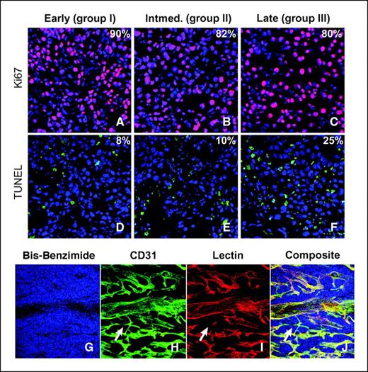 Figure 2. Apoptosis and proliferation as a function of tumor progression. A–F, Ki67-positive tumor cells (A–C; pink) and TUNEL-positive tumor cells (D–F; green). Blue, bis-benzimide nuclear counterstain. Percentages represent positive staining for either Ki67 or TUNEL tumor cells. G–J, complex vasculature in murine neuroblastoma tumors; bis-benzimide nuclear counterstain (G), CD31 immunoreactivity (H), rhodamine-conjugated lectin (I), composite (J). Arrows, vessels positive for CD31 but negative for rhodamine-conjugated lectin. Apoptosis and proliferation were examined by confocal microscopy at 63× magnification, and vascular staining was examined at 20× magnification.