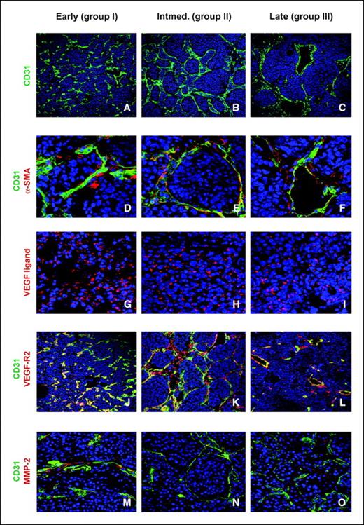 Figure 3. Angiogenic factors contributing to murine neuroblastomas. A–C, CD31-positive endothelial cells (green) and bis-benzimide nuclear counterstain (blue). D–F, association of pericytes with endothelial cells is similar in all tumor groups. Bis-benzimide nuclear counterstain (blue), endothelial cells stained for α-CD31 (green), and α-SMA stained for pericyte positivity (red). G-I, VEGF ligand is localized in the cytoplasm and is abundant in all groups. Bis-benzimide nuclear counterstain (blue) and VEGF ligand (red). J–L, VEGF-R2 localizes with endothelial cells lining the blood vessels. Bis-benzimide nuclear counterstain (blue), endothelial cells stained for α-CD31 (green), and VEGF-R2 immunoreactive cells (red). Yellow represents a colocalization of endothelial cells with cells expressing VEGF-R2. M–O, MMP-2 immunoreactivity adjacent to endothelial cells. Bis-benzimide nuclear counterstain (blue), CD31 endothelial cell marker (green), and MMP-2 immunoreactive cells (red). Slides examined by confocal microscope at either 20× (CD31 and VEGF-R2), 40× (VEGF ligand and MMP-2) or 63× (α-SMA) objective.