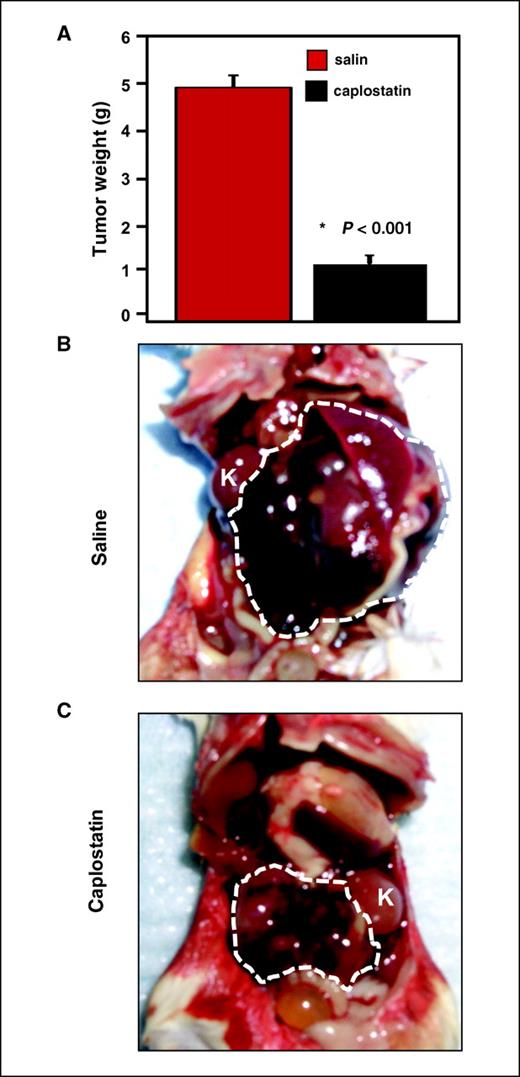 Figure 5. Treatment of established murine neuroblastoma tumors with caplostatin (HPMA-copolymerized TNP-470). Treatment as in Fig. 4, with either saline or caplostatin (50 mg/kg TNP-470 equivalent dose, i.p. thrice weekly for 2 wks at 50% of the TNP-470 equivalent dose used in Fig. 4). A, tumor weight was significantly reduced (P < 0.001). B, saline-treated tumors progressed rapidly. White dashed line defines extent of tumor; K, kidney. C, caplostatin-treated tumors were grossly smaller (white dashed line defines extent of tumor). A, columns, mean; bars, SE (n = 8 mice per group).